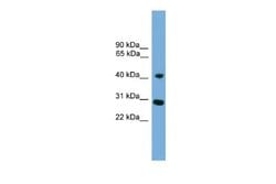 CLS1 Rabbit anti-Human, Polyclonal, Novus Biologicals 0.1 mL | Buy Online | Novus Biologicals | Fisher Scientific